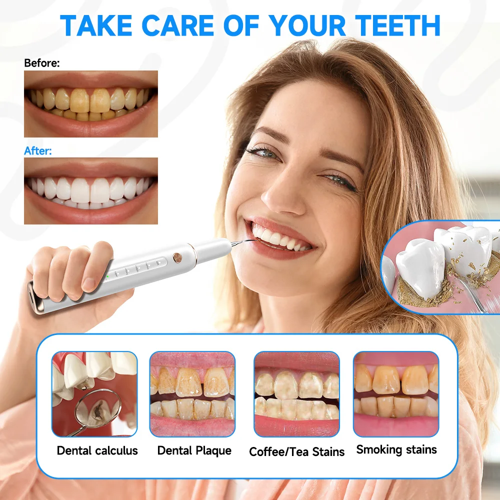 Curvy moon t4 portátil ultra sônico escova de dentes elétrica profissional placa cálculo remoção manchas dente removedor ferramentas limpeza
