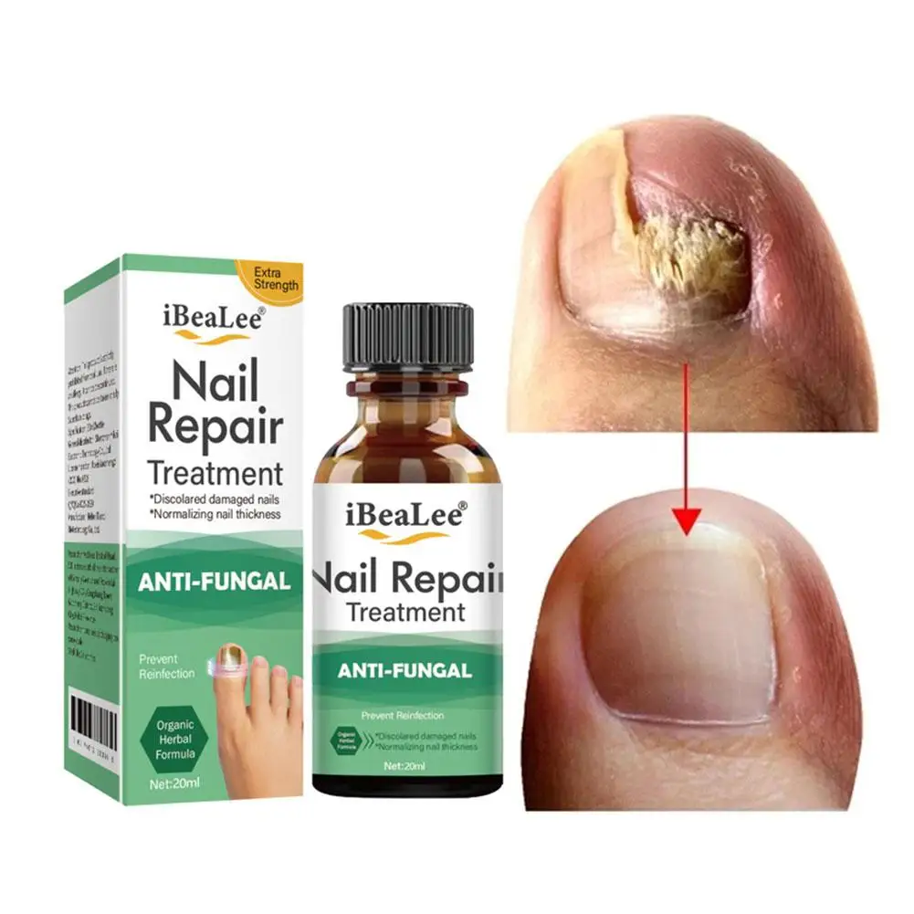 20ml Nail Solution Hand And Foot Thickening Type Gray Nail Gray Solution Nail Nail Cleaning Solution Nail Bright Soft U3V2