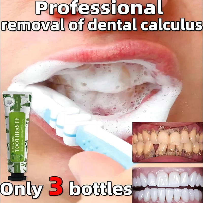 Removedor de pasta de dientes, productos para el cuidado bucal, blanqueamiento de cálculo Dental, eliminación de olores bucales, mal aliento, prevención de Periodontitis, nuevo