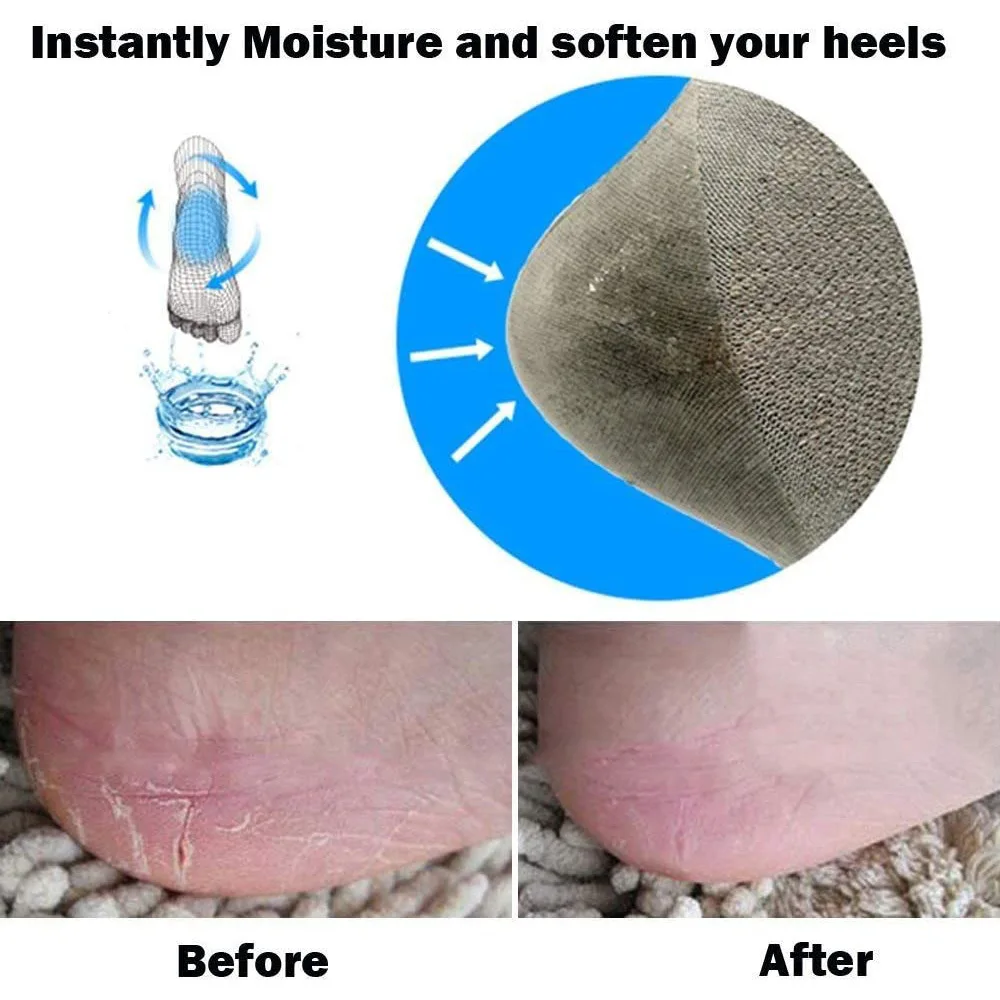 Calcetines de Gel para el talón, 2 uds., calcetines hidratantes de Gel para Spa, cuidado de los pies, Protector de piel dura y seca para el talón, herramientas para el cuidado de los pies