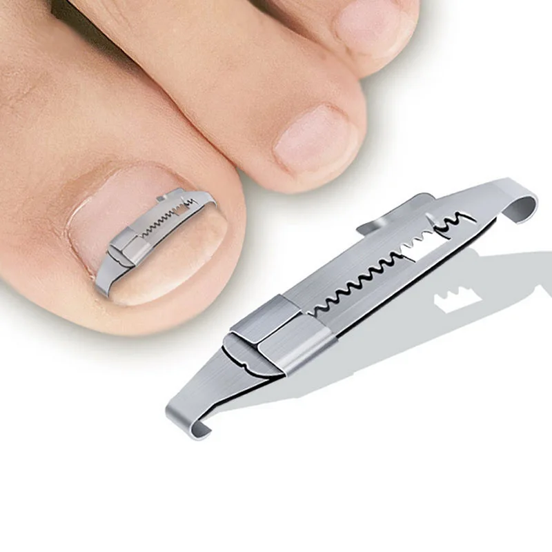 Toe Ingrown Pedicure Nail Buckle Toenails Corrector Foot Nail Correction Tool Straightening Clip Curved Brace Corrector