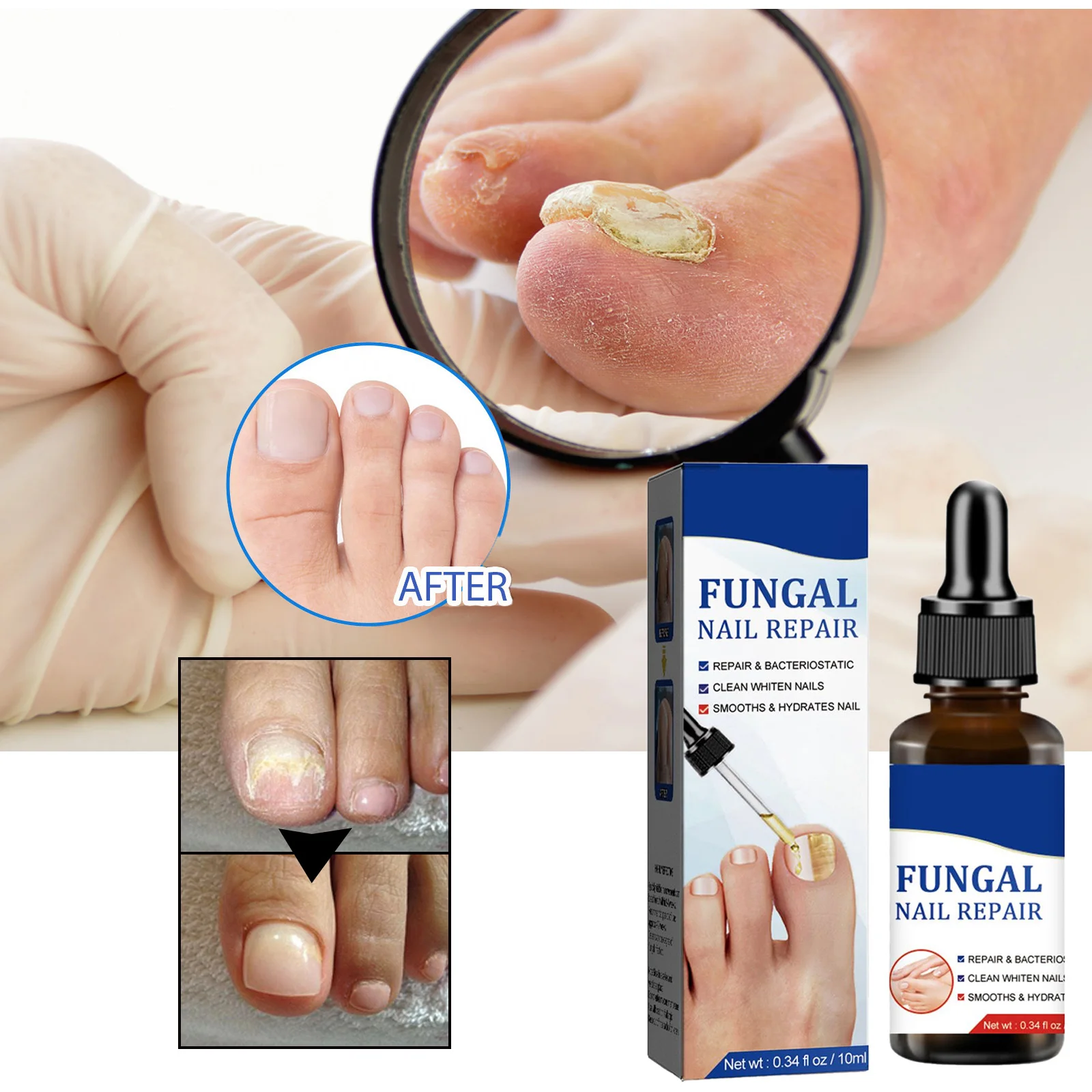 Nail Fungals Renewal Nail Repair Liquid for Discolored Thickened Crumbled Nails Nail Fungals for Discolored Broken Cracked BS8.0