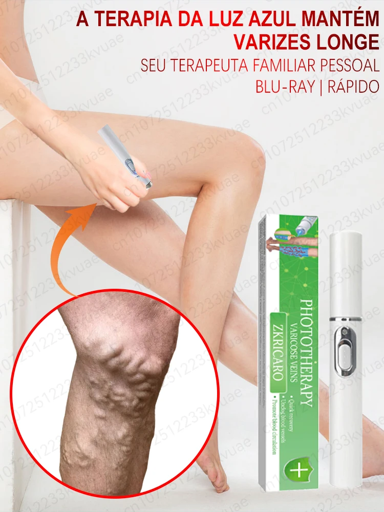 Laser Equipment for Varicose Veins, Clear varicose veins and Relieve Legs