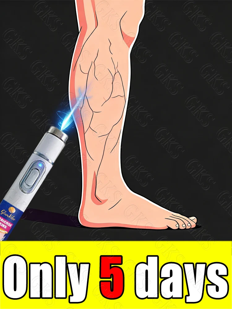 Upgraded blue light pen to improve leg appearance and discomfort.