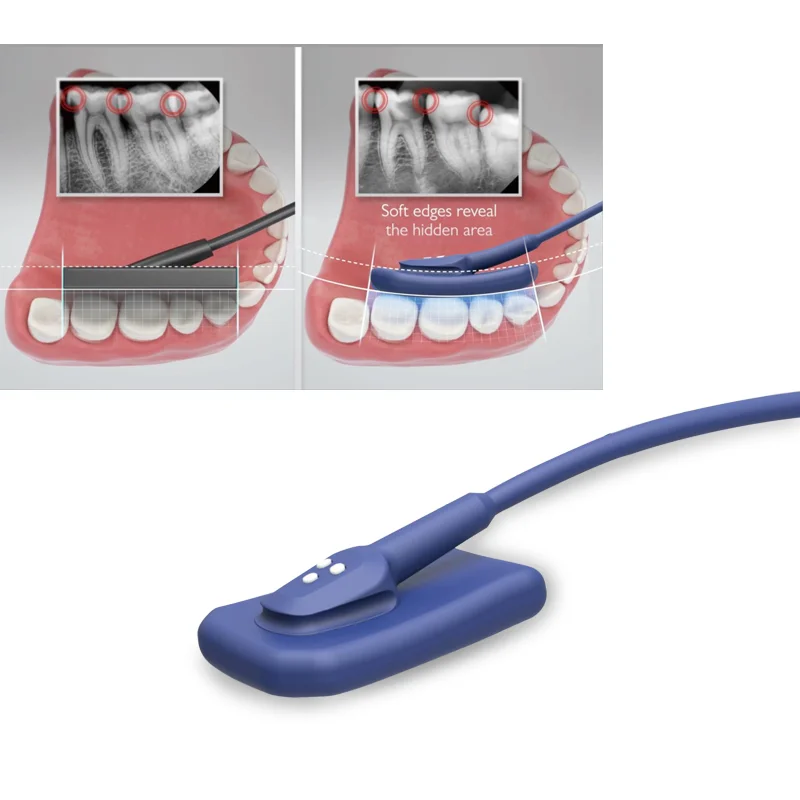 

Newest Vatech High Pixel Portable Den tal Intraoral X Ray RVG Sensor