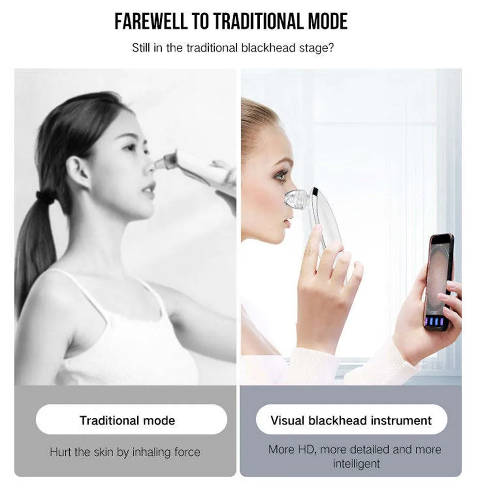 Electric Intelligent Visual Skin Care Blackhead Remover Vacuum Tool