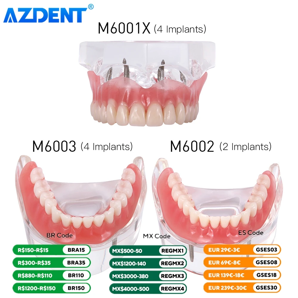 Dental Implant Teeth Model AZDENT Removable Interior Mandibular Demo Overdenture With Implants Upper Lower Tooth Teaching Study