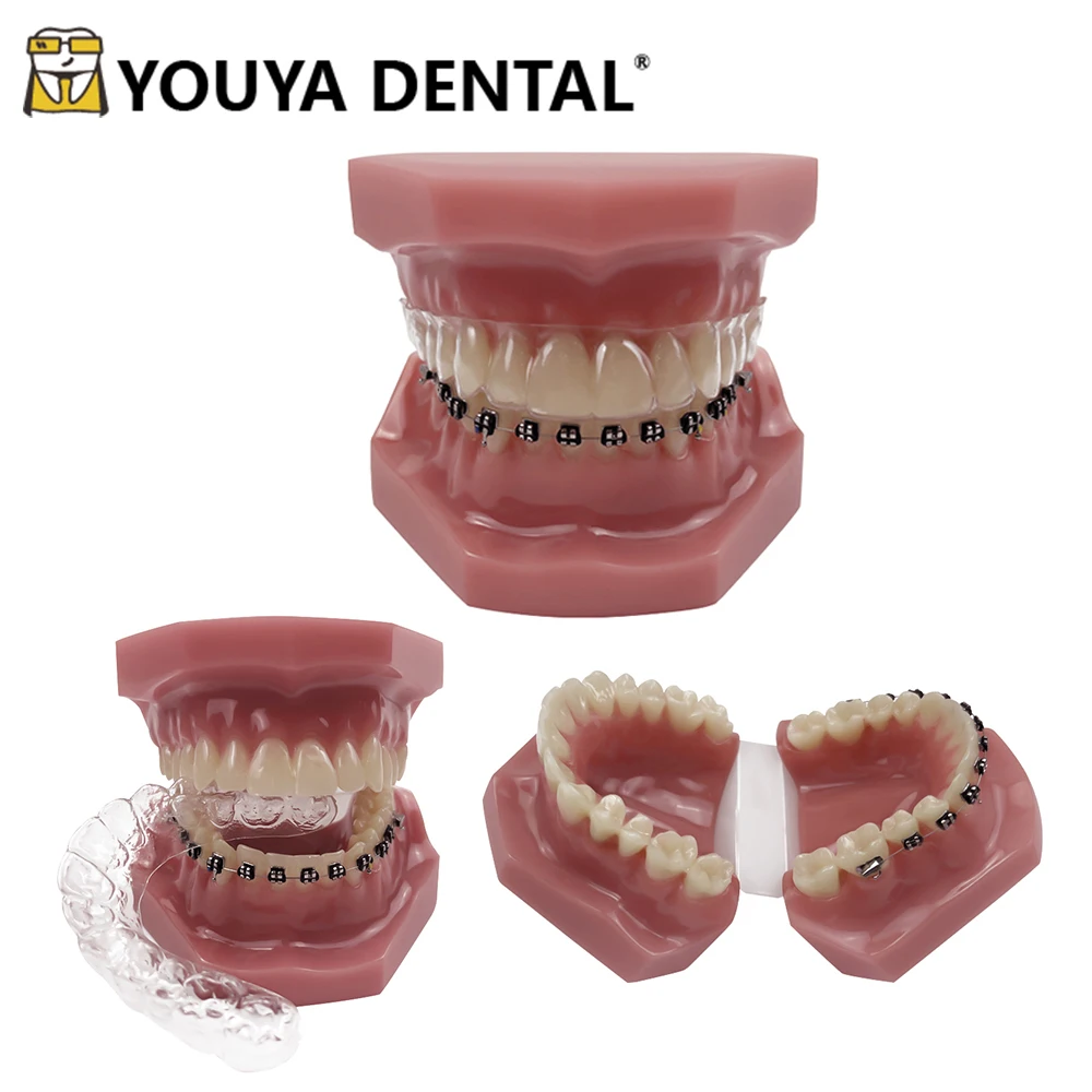 

Teeth Model Invisible Bracket Orthodontic Teaching Model for Dentist Technician Practice Studying Patient Communication Tools