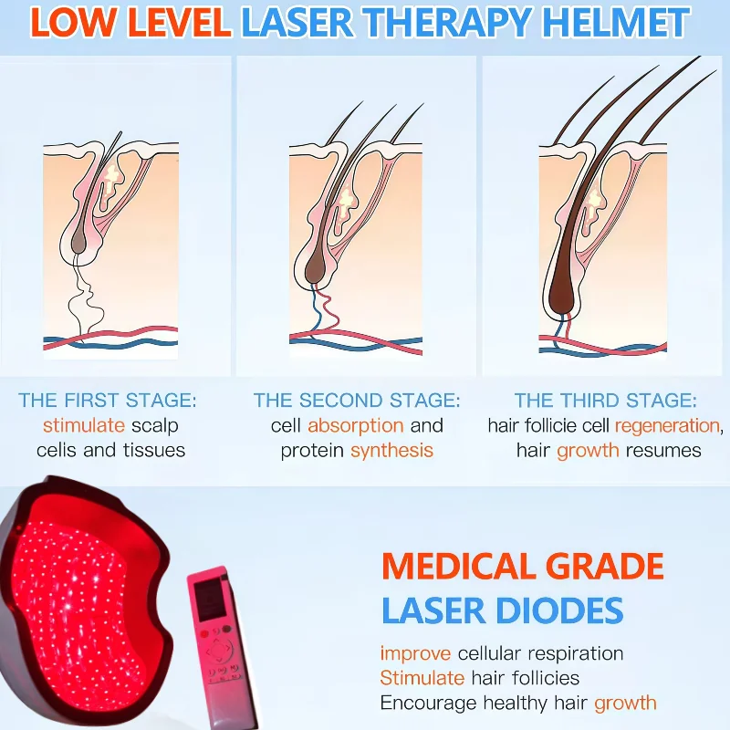 Portable LLLT Hair Growth Cap Wireless Red Light Therapy 300pcs Medical Diodes for Hair Growth Stimulation