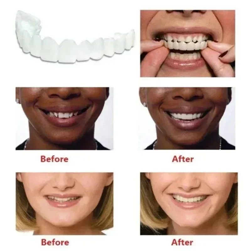 Capa de dente falso ajuste perfeito clareamento dos dentes snap em silicone sorriso folheados dentes dentaduras flexíveis ferramenta beleza