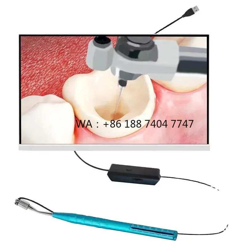 HD Micro Oral Recording Device Micro Lens Visual Micro Recording Device for Root Canal Treatment