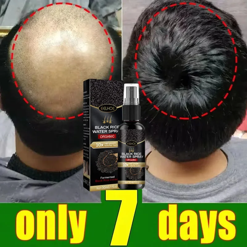 

Black Rice Fast Hair Growth Serum Spray for Men Women Anti-loss Hair Regrowth Essential Oil Scalp Treatment Hair Care Products