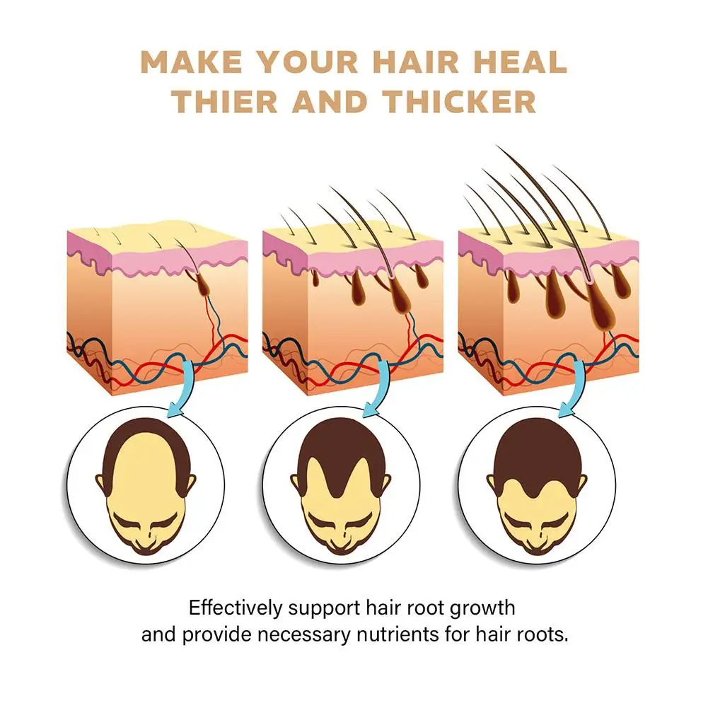 شامبو منشط الجذر، بلسم إعادة نمو الشعر الرمادي، صابون شامبو لتقوية الشعر من أجل لهاي ناعم وقوي K9J2 #4