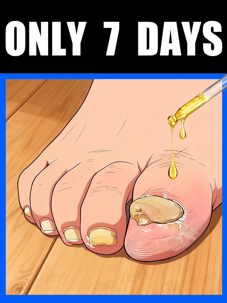 2025 Elimina rápidamente los hongos y restaura las uñas saludables.