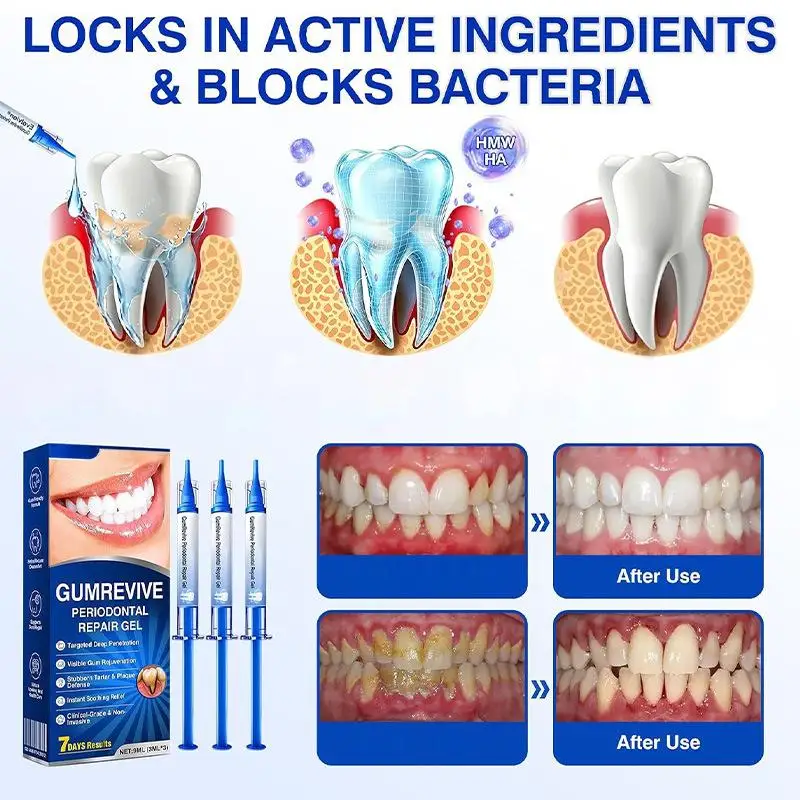 GUMREVIVE PERIODONTAL REPAIR GEL Instant Soothing Relief Stubborn Tartar Plaque Dental Oral Care Periodontal Repair Gel Syringes