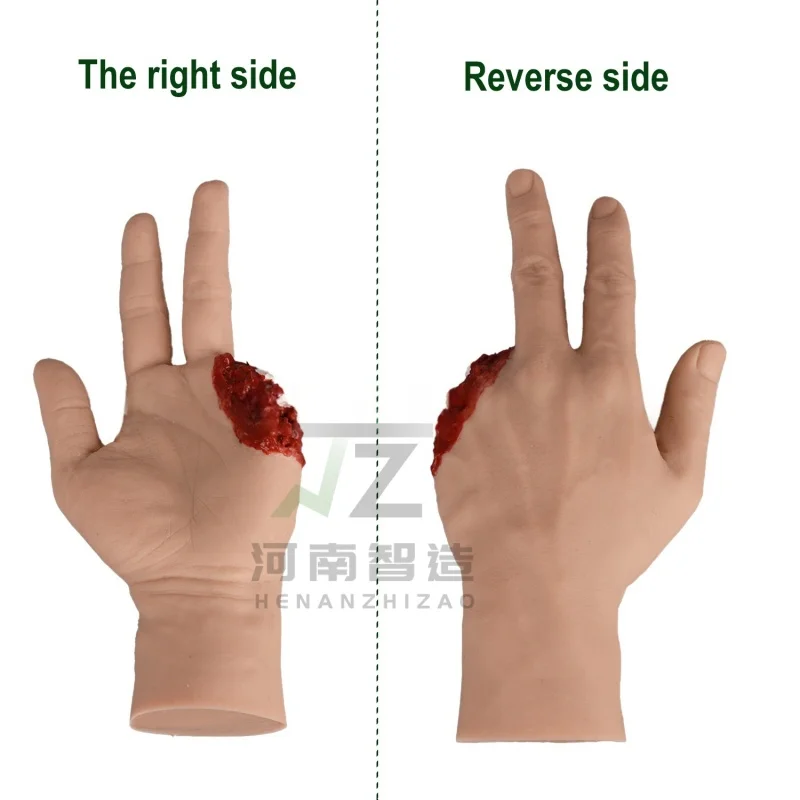 Silicone Hand Amputated Wound Simulator Bleeding Hemostasis Control Training Trauma Amputation Finger Care Palm Model