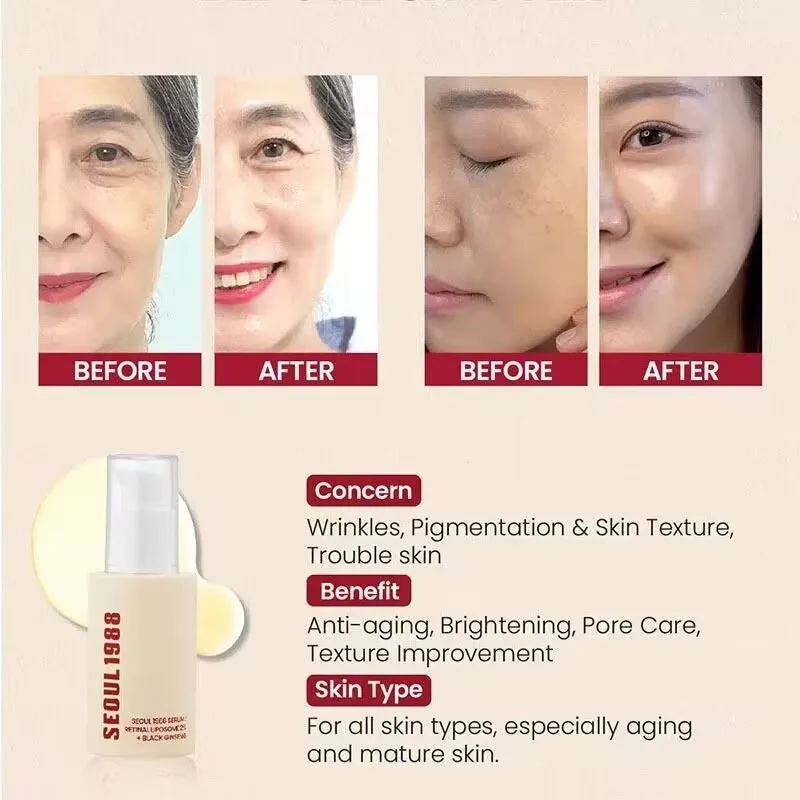SEOUL 1988 Conjunto de brilho hidratante hidratante vitamina C cuidados com as rugas 4% retinol ginseng soro facial firme linhas finas creme para os olhos