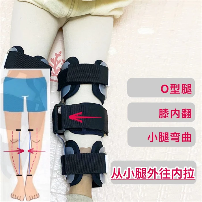 Shuyan Jiao O/X Leg Type Correction Belt Pediatric Kids Leg Posture Corrector Brace for Children Knees Valgus Straighten