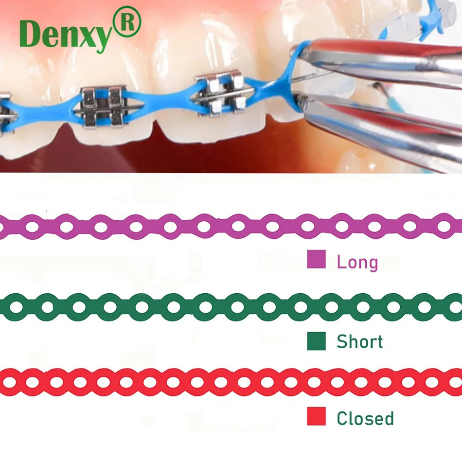 Denxy 2 Stück Kieferorthopädische Ultra-Elastische Power-Ketten für Zahnärzte, Bunte Endlos-E-Chain-Ketten für Zahnspangen, Dentalmaterialien – Detail 8