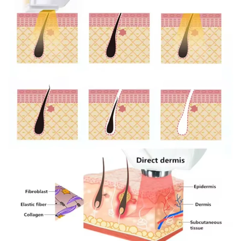 

2 in 1 Multifunctional Beauty Machine Picosecond Tattoo Removal 808nm Diode Laser Hair Removal Ice Platinum Skin Rejuvenation
