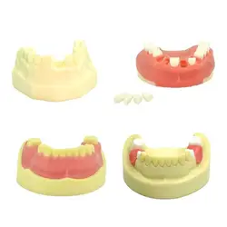 1 sztuk Dental Implant Model zębów Dental Model zębów nauczania badania modelu Implant dentystyczny narzędzie stomatologiczne