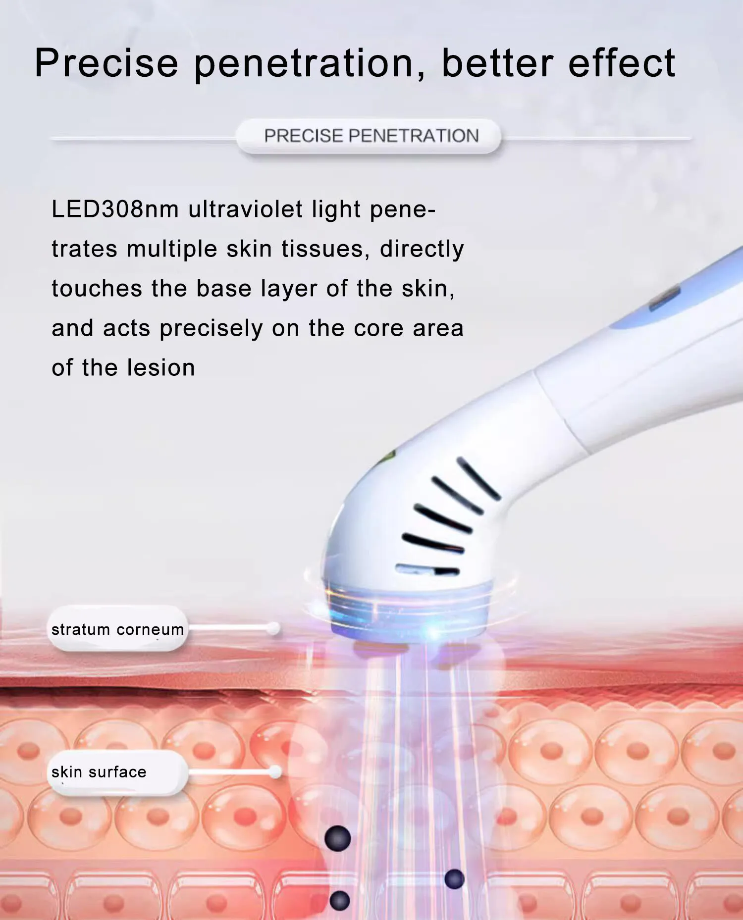 Tratamento de tamanho pequeno KN-4003B2 lâmpada de fototerapia UVB de banda estreita para cura de psoríase vitiligo
