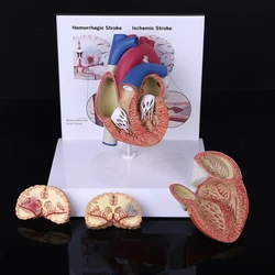 Life Size Disassembled Anatomical Human Heart Anatomy Model for School Science Resources Study Display Teaching Tool H8WD