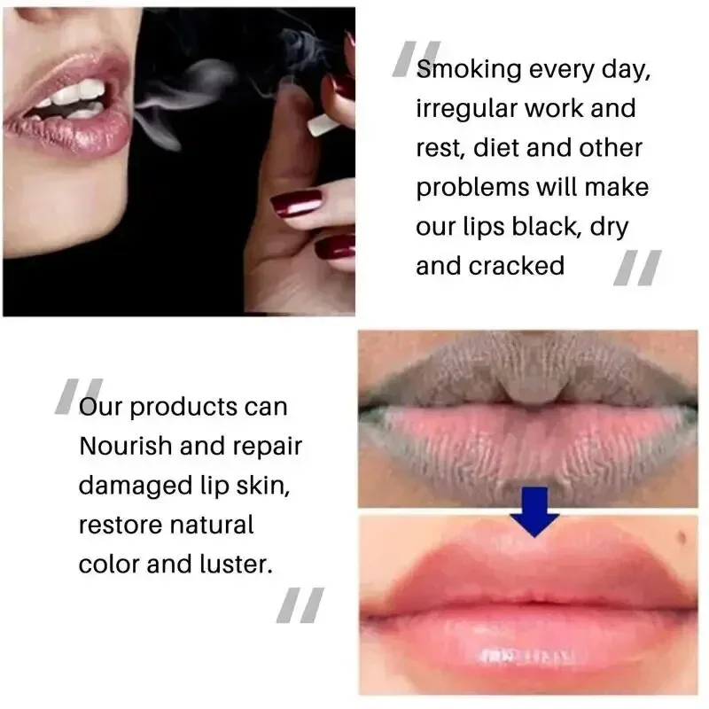 Whitening Remove Dark Lip Balm Moisturizing Cream Hyaluronic Acid Exfoliating Dead Skin Lightening Pigment Care Beauty Health