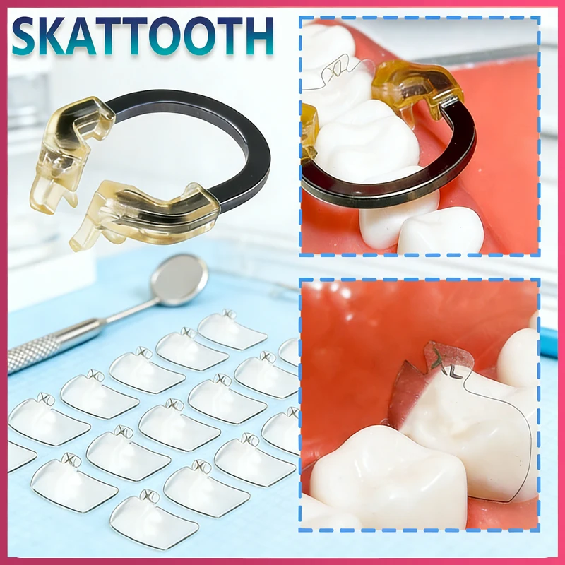 

Стоматологические полимерные матричные ленты NITI, зажимное кольцо, прозрачные матрицы, стоматологическая секционная контурная матричная система для заднего зуба