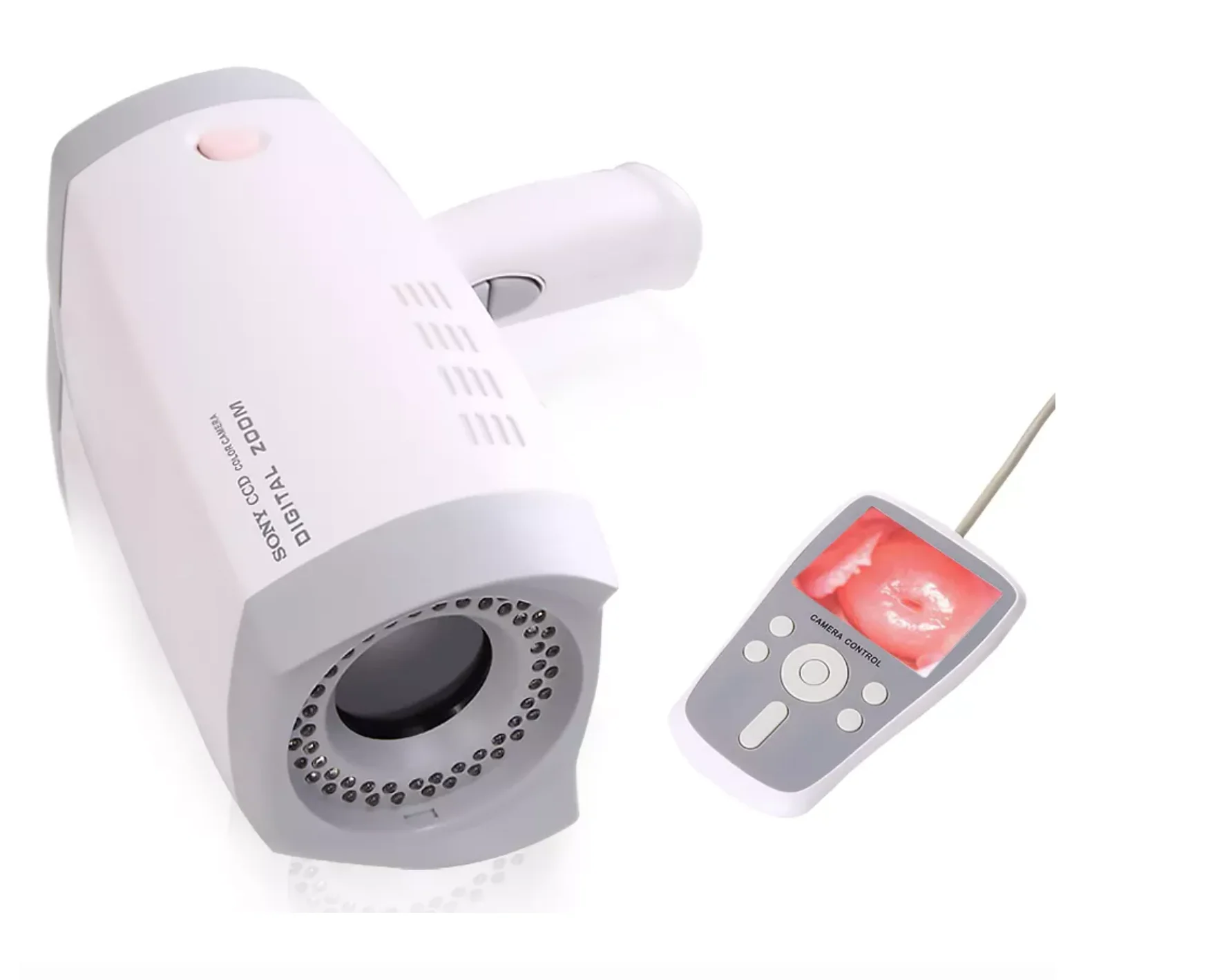 YD-220A Digitale Handheld Direct-To-Screen Video Colposcopie Mobiele Digitale Draagbare Digitale Vagina Video