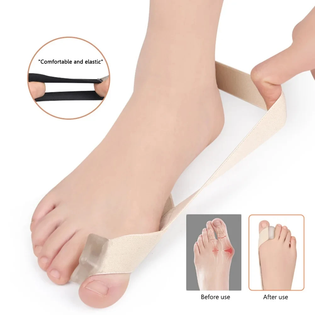 Unisex Toe Straightener Corrector Daily Wear Big Bone Toe Bunion Pull Strap Elastic Toe Separator Straightener for Foot Supplies