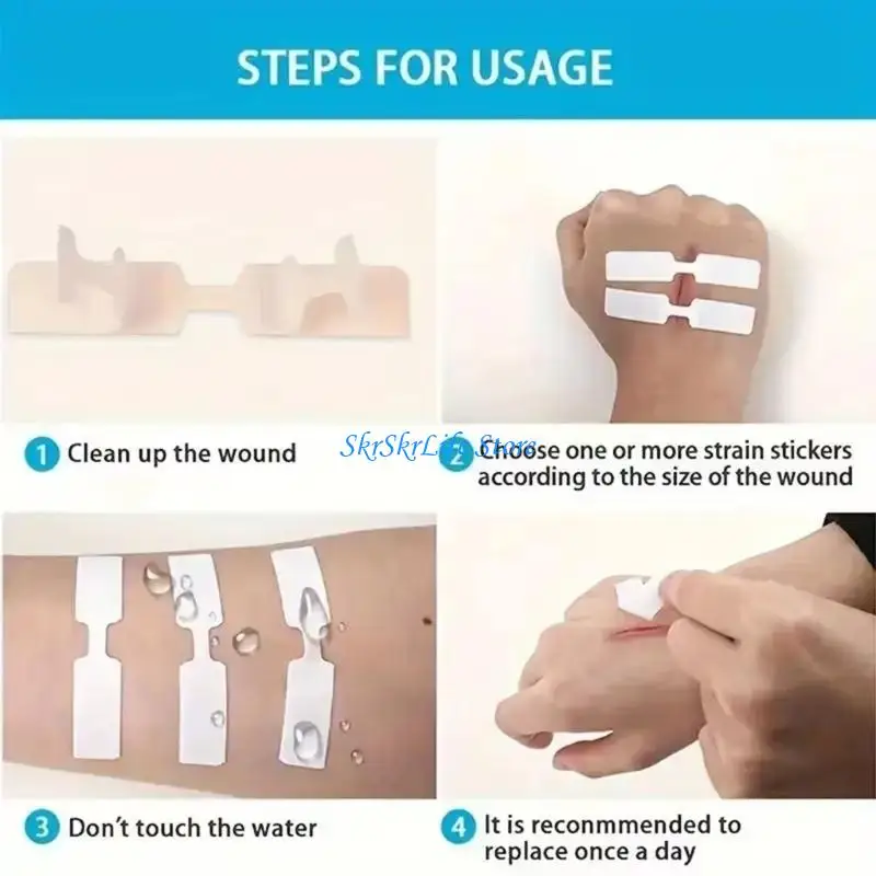 E65E Adhesive Wound Closure Strips Waterproof Fabric Adhesive Bandages Wound Strips Set For Joints And Sensitive Skin Areas