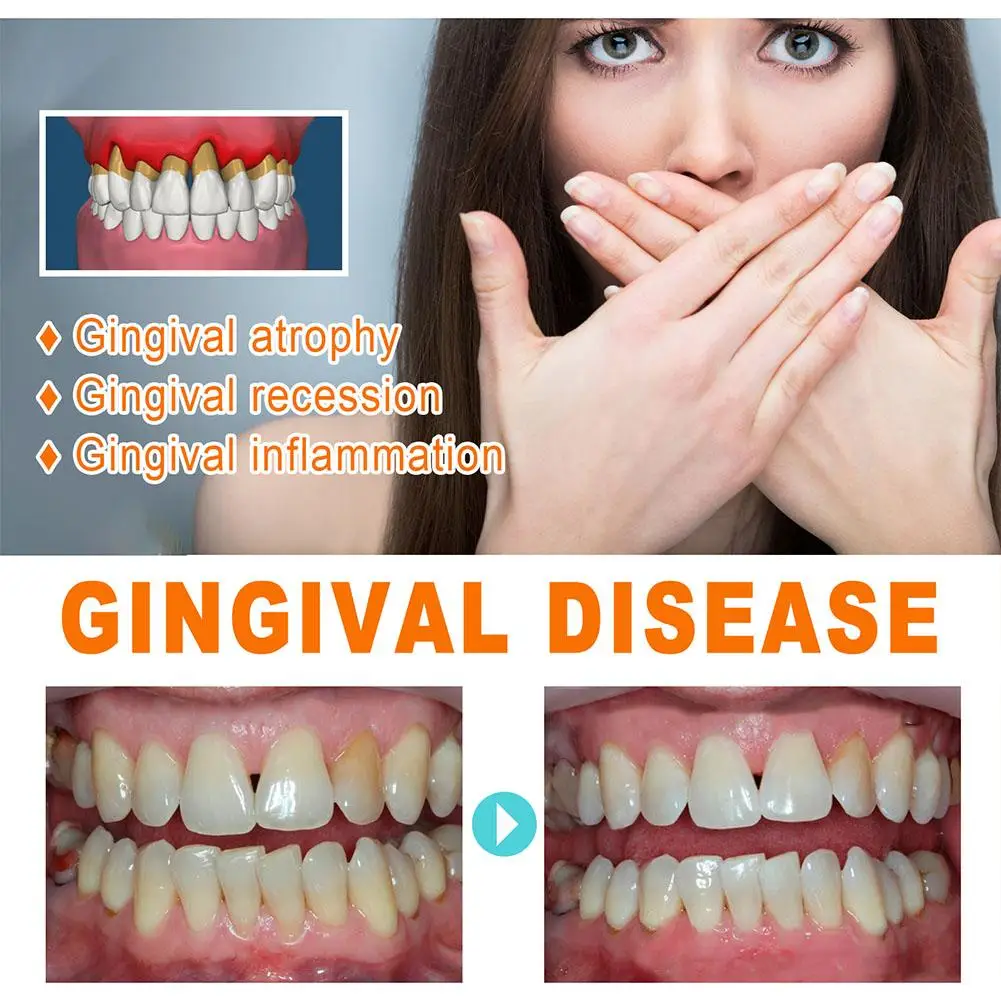 Fiale per il trattamento della riparazione delle gengive igiene orale pulizia dell'essenza mal di denti Gingiva gonfiore rimuovere il respiro liquido sollievo dalle gengive T5y6