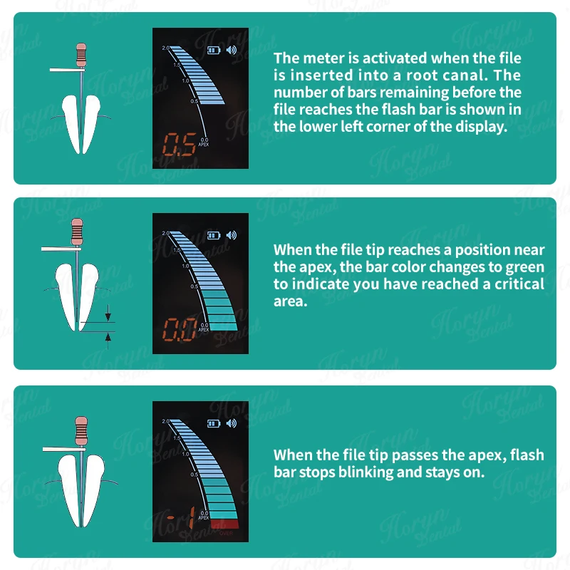 Thumbnail 4 - #48 Compare Pulp Vitality Testers Before You Buy