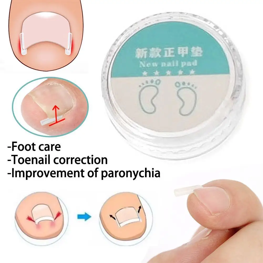 

50pcs Ingrown Toe Nail Treatment Ingrown Toenail Correction Tool Elastic Patch Sticker Straightening Clip Brace Pedicure Tools