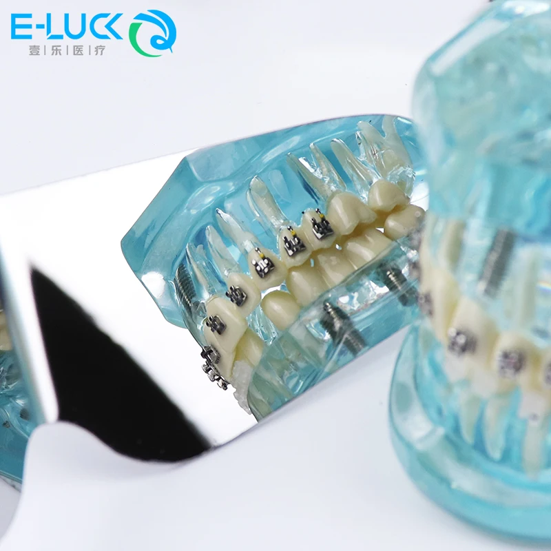 

Зеркала для стоматологической фотографии, автоклавируемые внутриротовые ортодонтические имплантаты из нержавеющей стали, отражатель, клинические инструменты