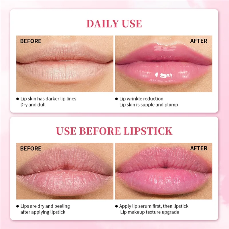 B60AIbcccndc Serum Lips Pink Fresh Remove Dark Lips Gel Lightening Essence Cream Balm Repair Fine Line Brighten Lip Exfoliator