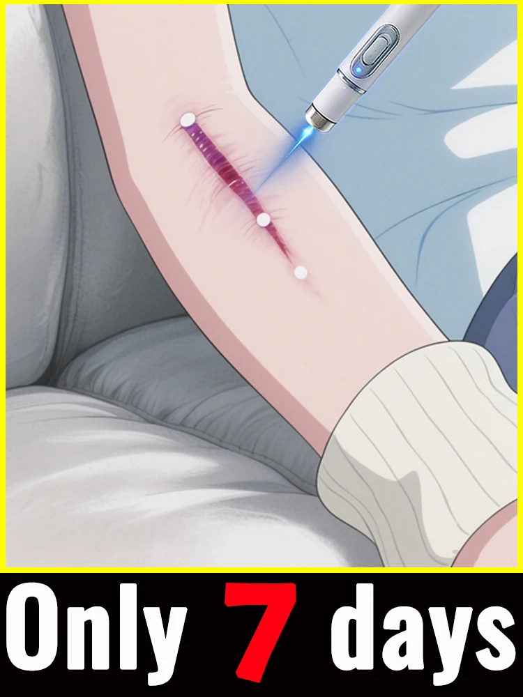 

Модернизированный шрам 2-го поколения ремонт корня шрама uickly