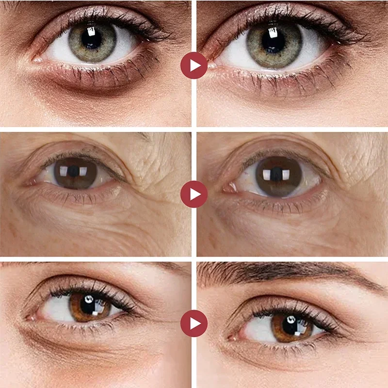 Crema para los ojos instantánea, eliminador de ojeras, bolsas para los ojos, antiarrugas, firmeza, blanqueamiento bajo los ojos, suero, belleza, salud, producto para el cuidado de la piel