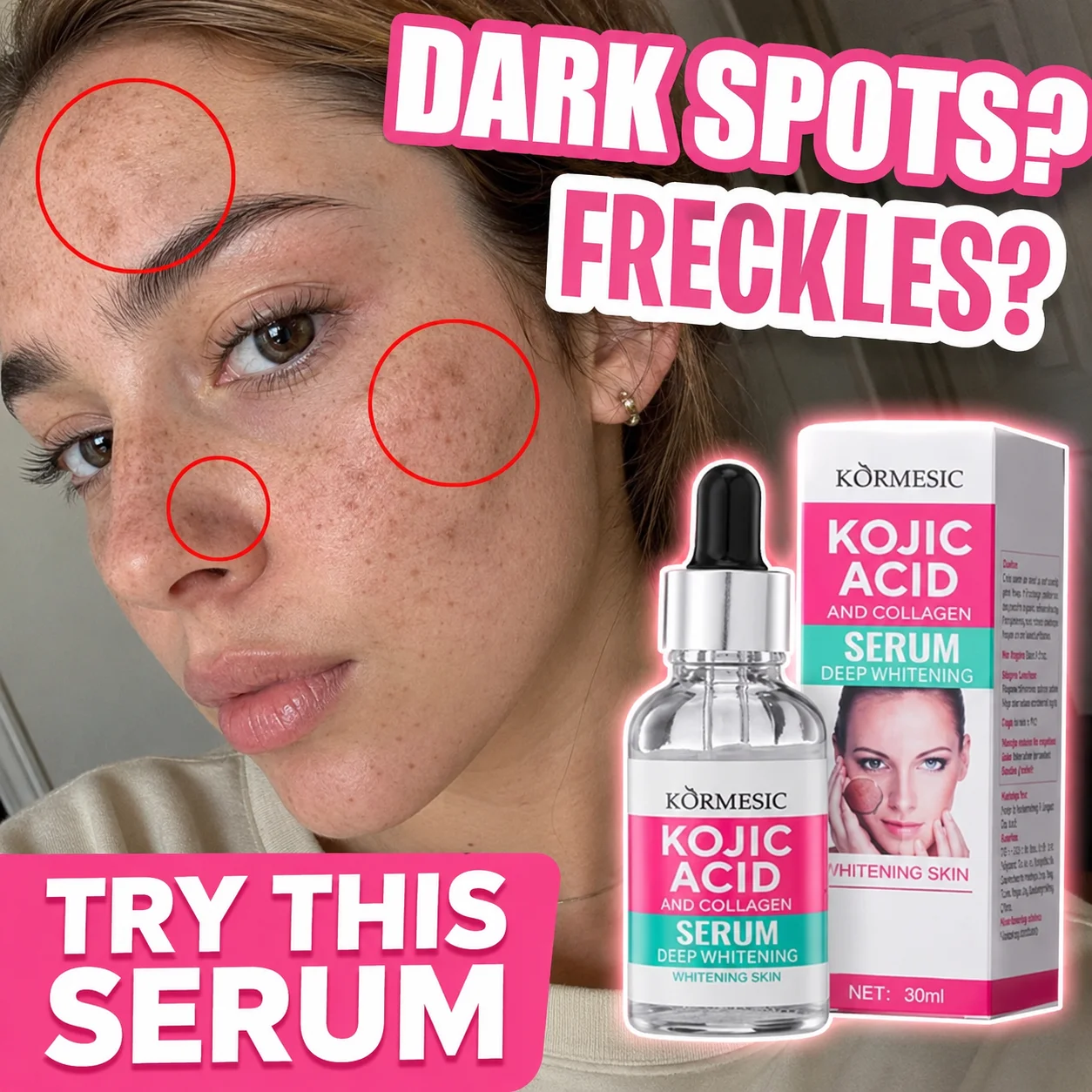 

Kojic Acid Collagen Whitening Serum 30ML Dark Spot Corrector, Freckle Removal Face Serum, Hyperpigmentation Melasma Skin Care
