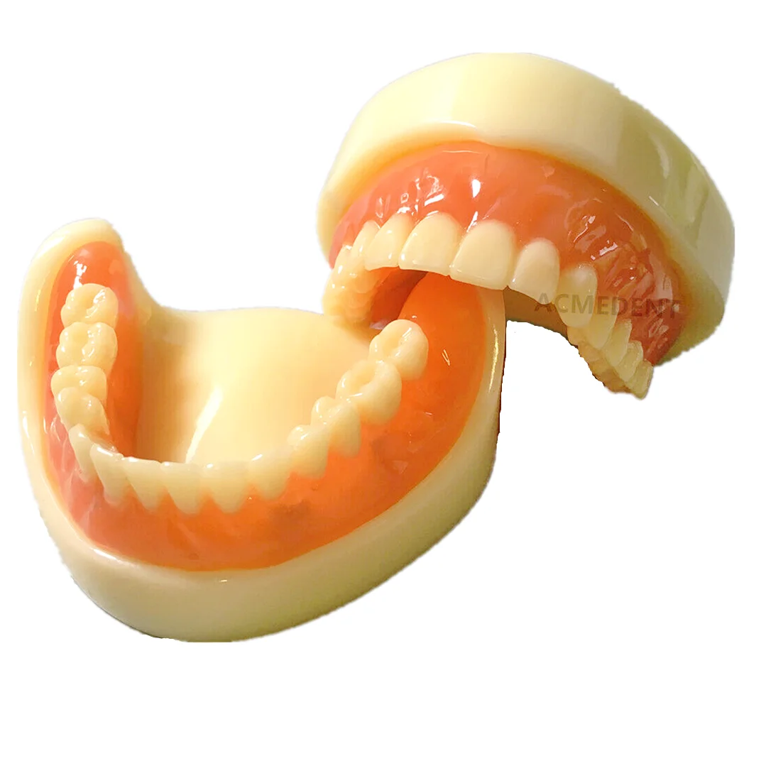 Dental pełna proteza Model Overdenture magnetyczne mocowanie górne badanie żuchwy