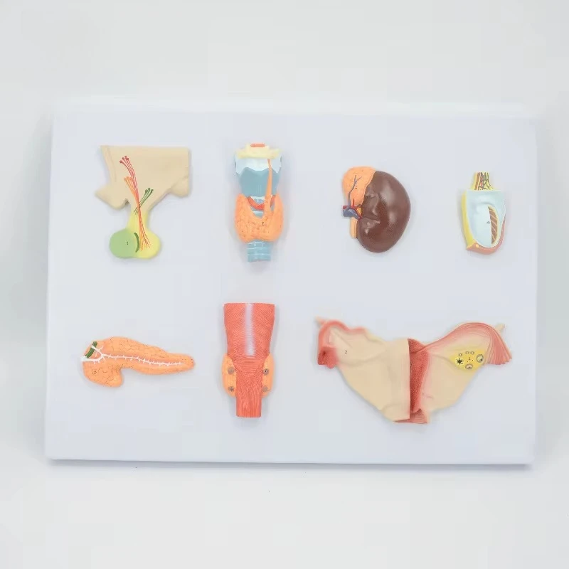 Human Endocrine Organ Model Human Endocrine System Anatomical Model Teaching Aid Endocrine Organ 7 Parts