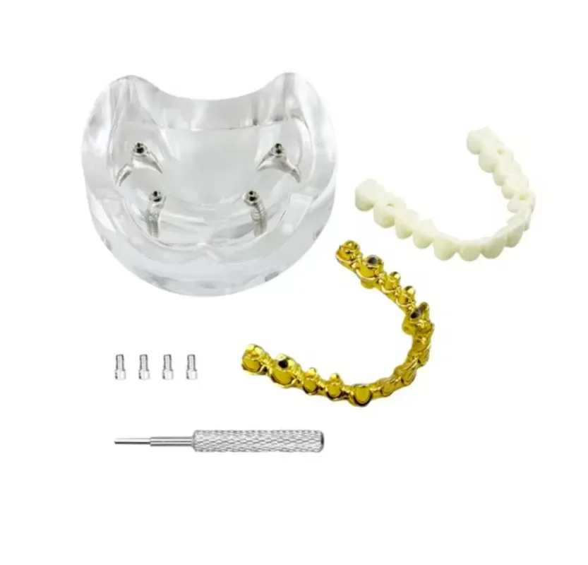 PP All-on-4 Lab Model | Implant Supported Bridge | Full Arch Teeth Replacement | Adjustable Resin Material