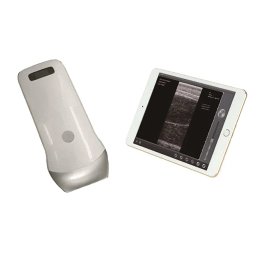 

Handheld Vet Ultrasound Machine Scanner Doppler Veterinary B-ultrasound Wireless Vet Ultrasound