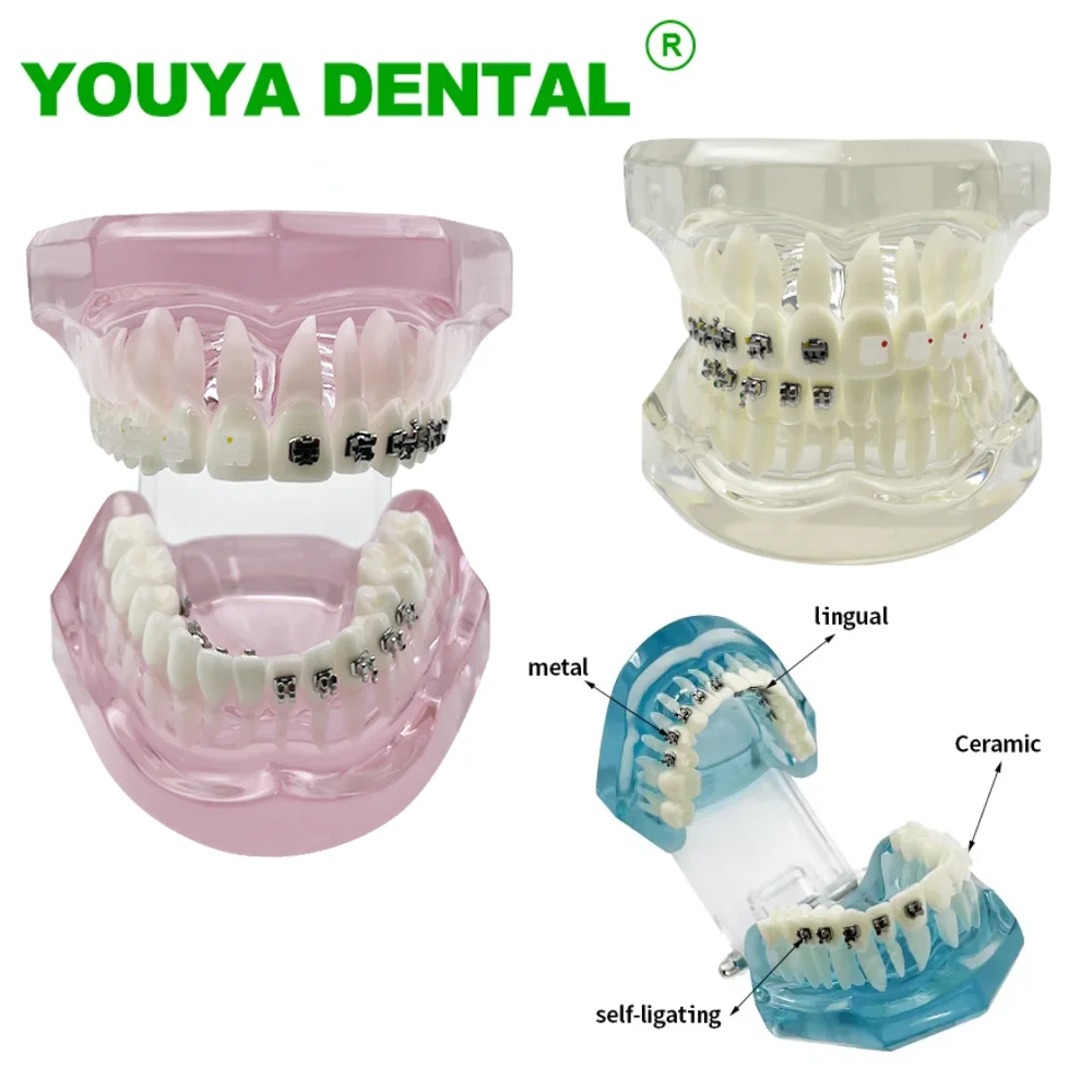 Dental Orthodontic Model With 4 Type Bracket Braces Typodont Teeth Model Dentistry Teach Study Demonstration For Patient Student