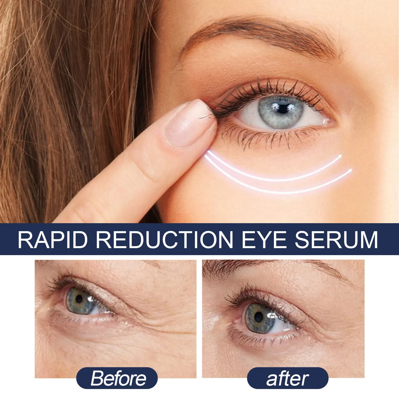 Dark Circles Removal Serum Anti Eye Bags Improve Fine Lines Anti Aging Puffiness Moisturizing Firmness Under Eyes Essence 5ml