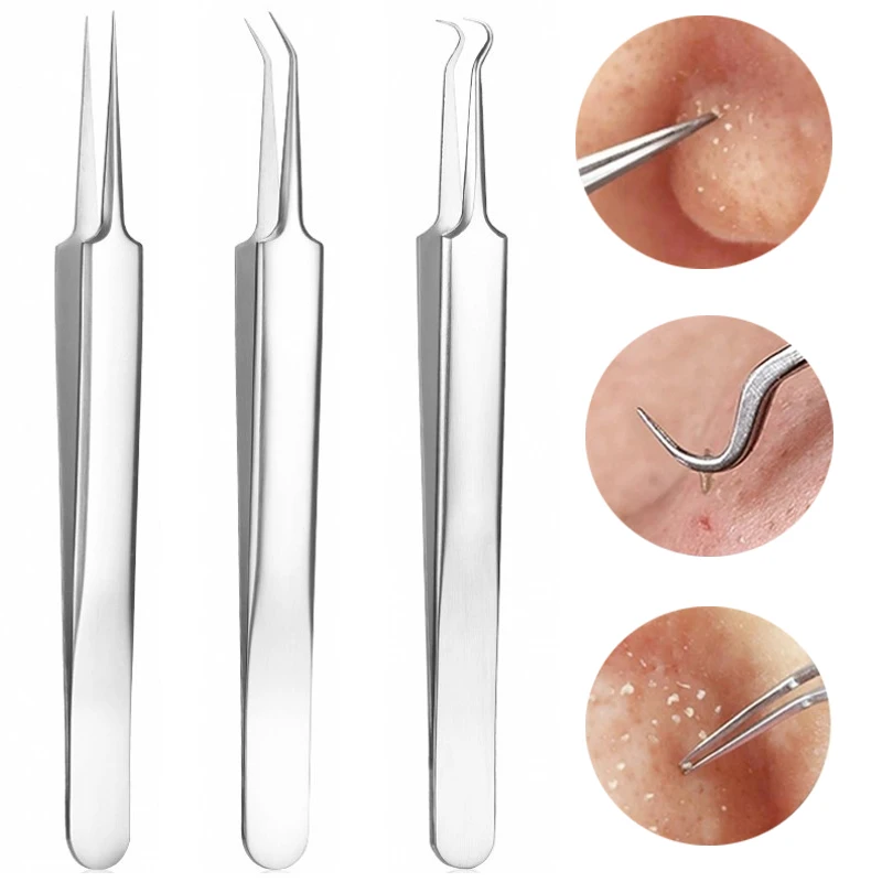 Stainless Steel Acne Clip Acne Needle Blackhead Removal Clip Whitehead Removal Needle Blemish Remover Tweezers Face Care  Tools