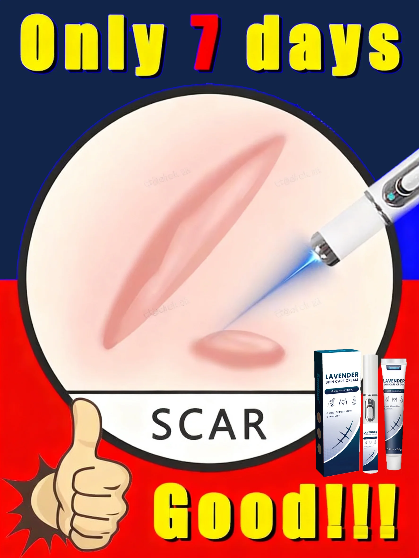 

Высокопроизводительная лазерная ручка: точные растяжки после беременности по мишеням