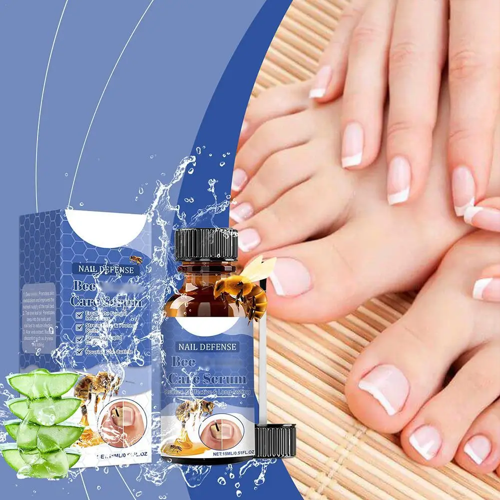 خلاصة العناية بفطر onycosis لسم النحل للأظافر والأظافر السميكة وأصابع القدم ، إصلاح سريع ، علاج ، العناية بالقدم ، 15 فطر