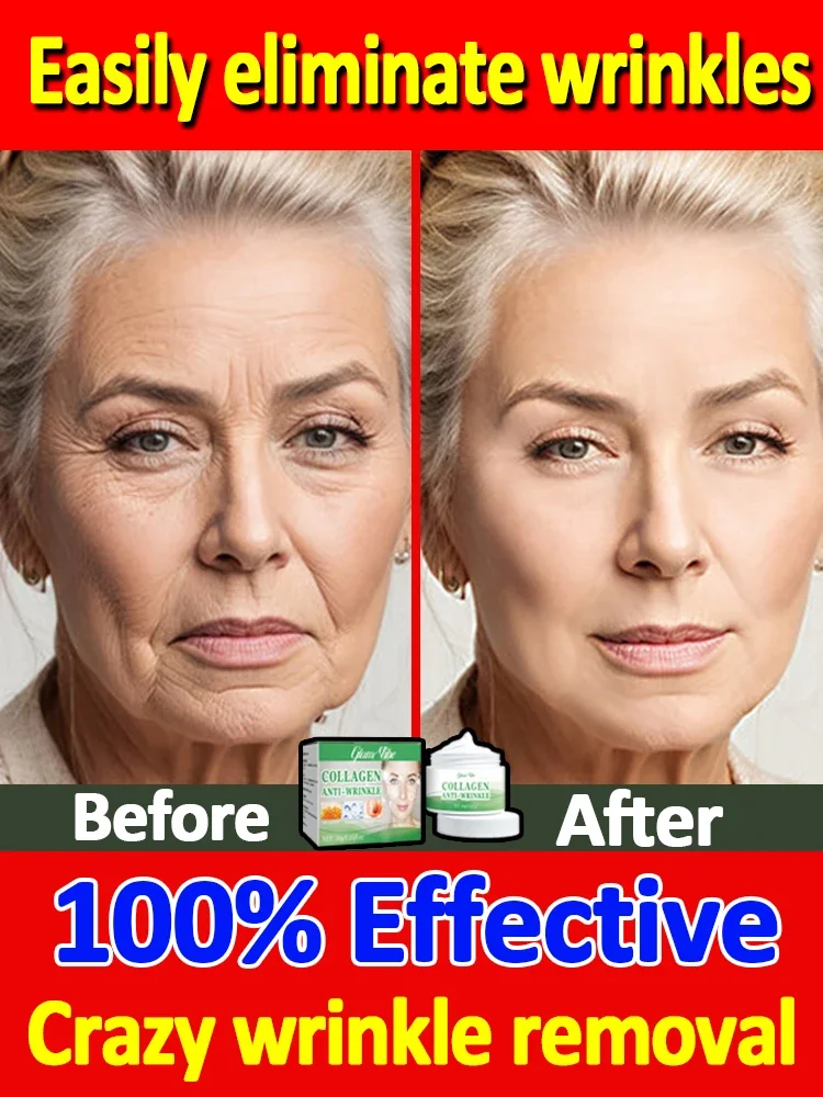 Wrinkles disappear in 7 days